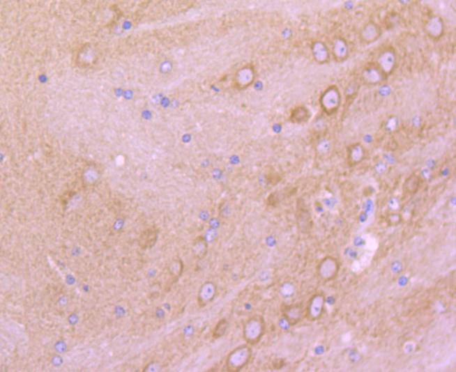 mGluR2 Antibody