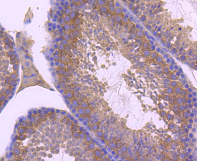 ZNRF2 Antibody