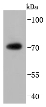 FUS/TLS Antibody