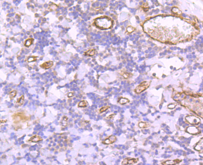 Von Willebrand Factor Antibody
