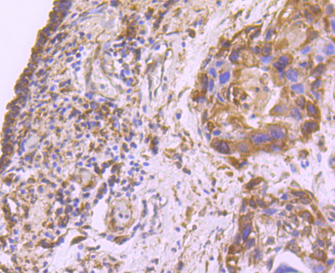 Fatty Acid Synthase Antibody