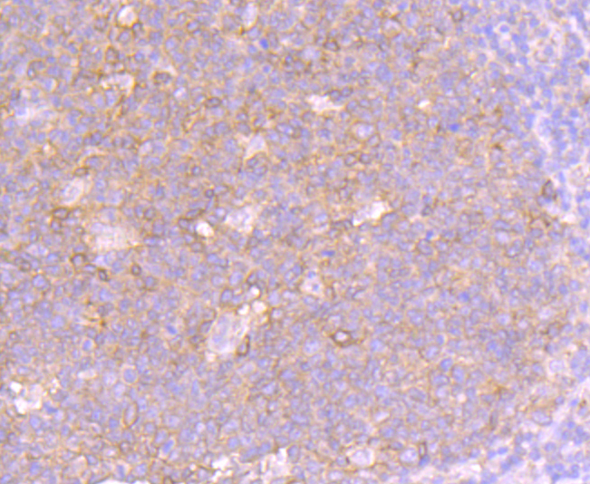 Fas(CD95) Antibody