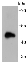 Doublecortin Antibody