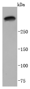 Laminnin 5 alpha 3 Antibody