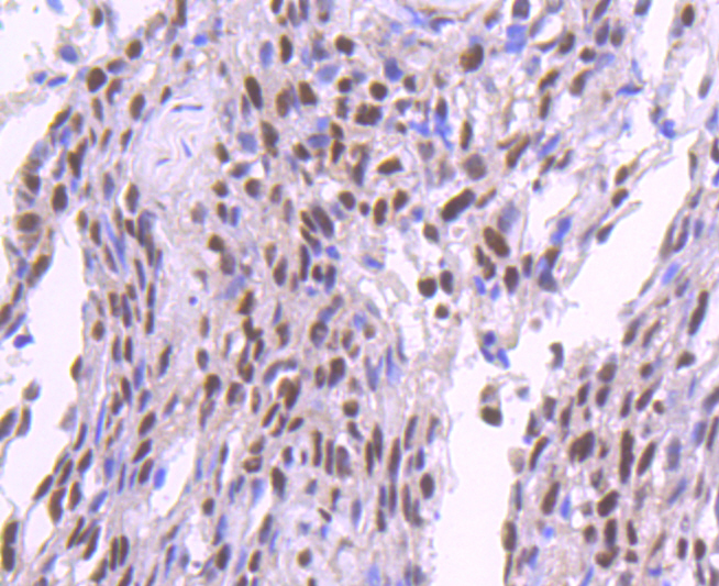 SP1 Antibody