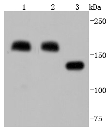 Mannose Receptor(CD206) Antibody