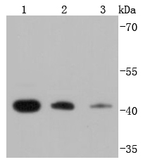 67kDa Laminin Receptor Antibody