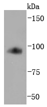 Transferrin Receptor (CD71) Antibody