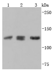 ABL2 Antibody