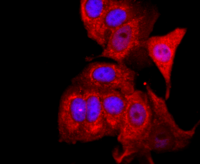 FOXP3 Antibody