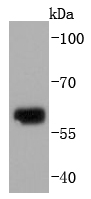 Collagen X Antibody