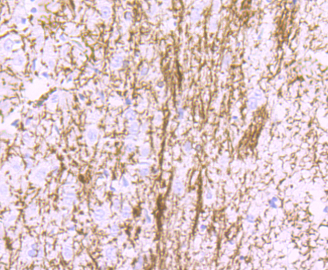 Myelin Basic Protein Antibody