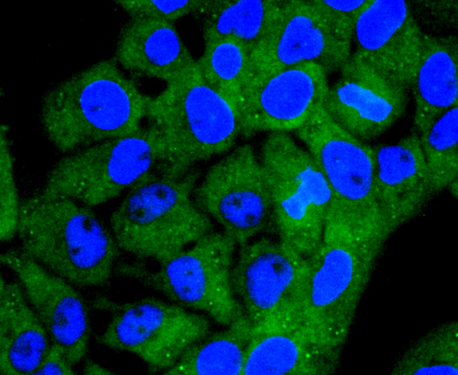 Acetyl CoA synthetase Antibody