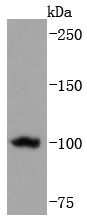 Telomerase reverse transcriptase Antibody