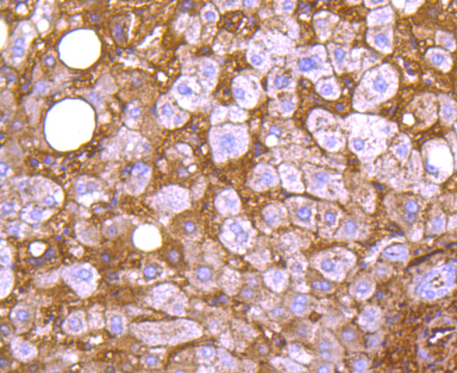 Apolipoprotein A1 Antibody