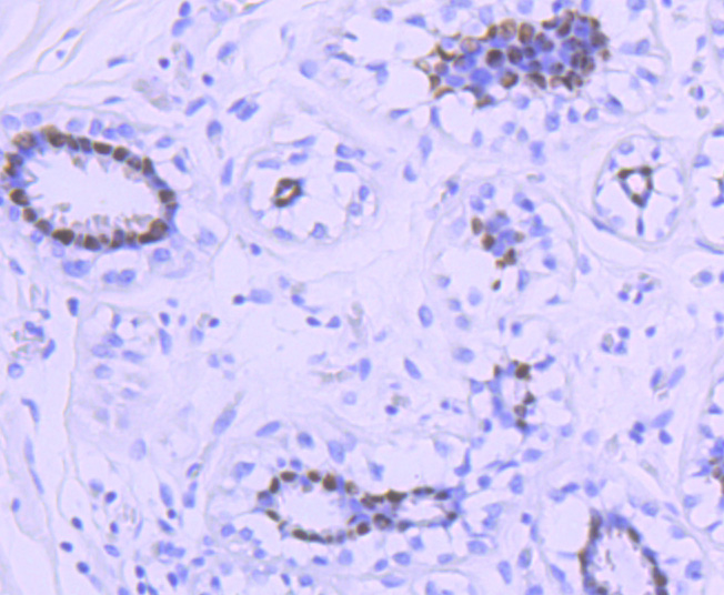 Progesterone Receptor Antibody