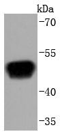 RAGE Antibody