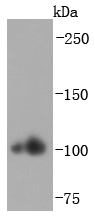Alpha Actinin 2 Antibody