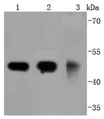 gamma Tubulin Antibody