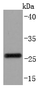CD99 Antibody