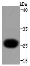 Cardiac Troponin I Antibody