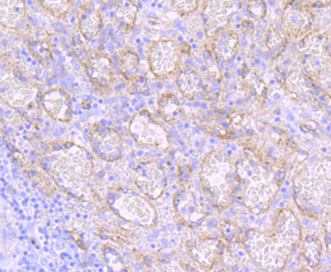 Dysferlin Antibody