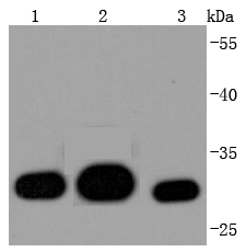 Galectin 3 Antibody