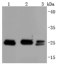 Bcl-2 Antibody