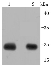 Calbindin Antibody