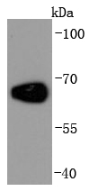 Albumin Antibody