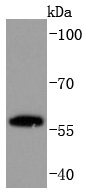 PPAR gamma Antibody