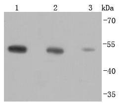 beta Tubulin(HRP conjugated) Antibody