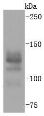 Ctip2 Antibody