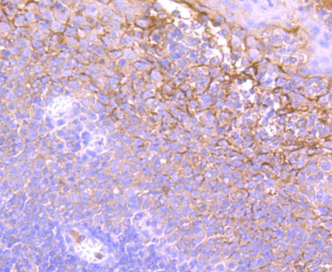 Neutrophil Elastase Antibody