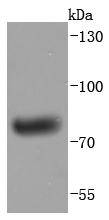 Human IgM Antibody