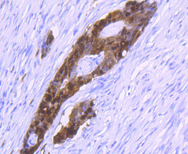 S100P Antibody