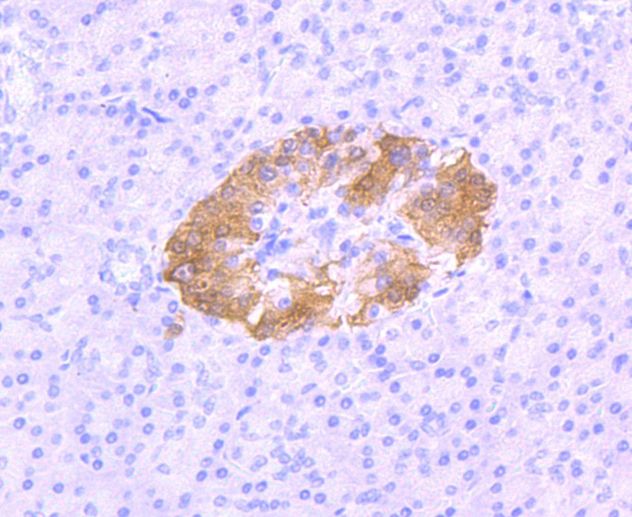 PGP9.5 Antibody