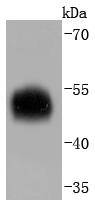alpha 1 Antitrypsin Antibody