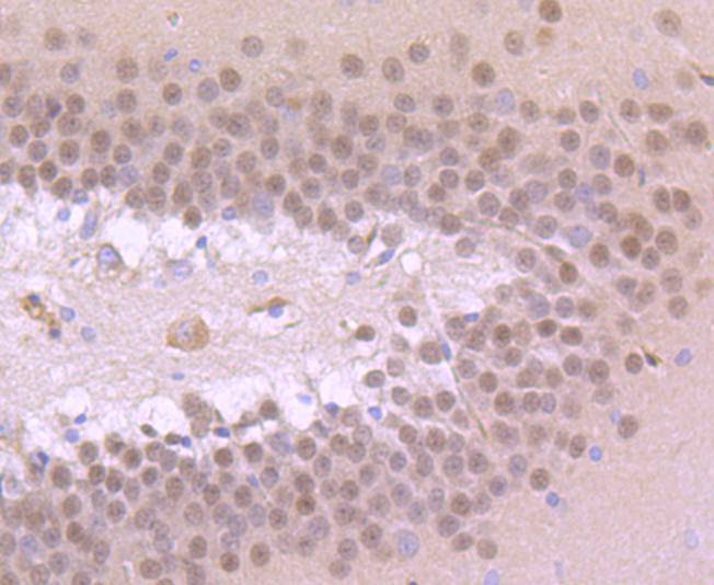 TBR1 Antibody