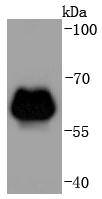 beta 2 Adrenergic Receptor Antibody