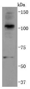 K63-linkage Specific Ubiquitin Antibody