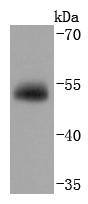 Vitamin D Binding protein Antibody