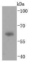 IgA Antibody
