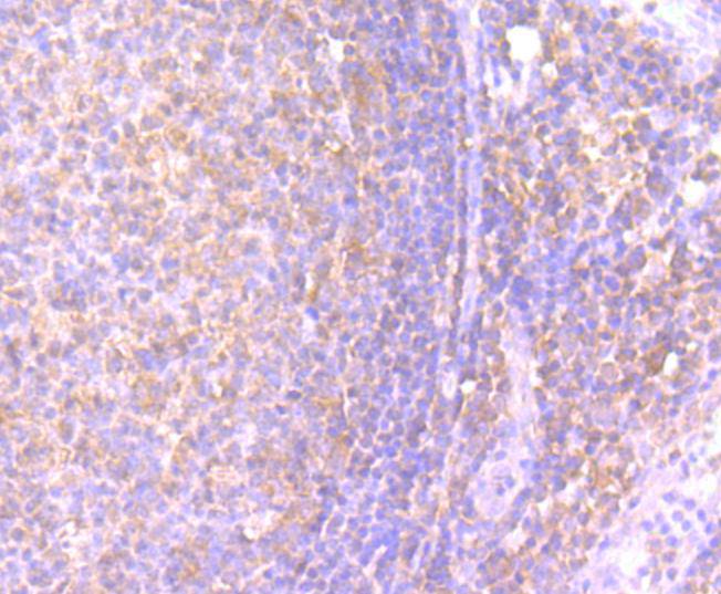 Interferon gamma Antibody