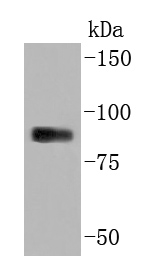 Myeloperoxidase Antibody