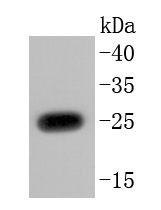 PGP9.5 Antibody