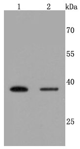 Haptoglobin Antibody