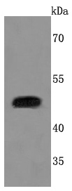 Urokinase Antibody