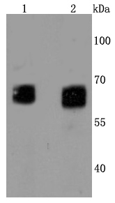 GBA Antibody
