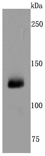CD41 Antibody